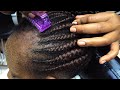 ASMR: Satisfying Aggressive Dandruff Removal and Facial Treatment Session
