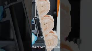 Aligner workflow with resin 3D-printing [Part 4/6]