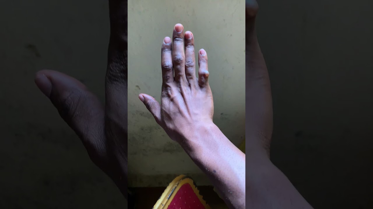 Não espere milagres