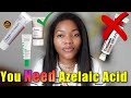 🚨7 Azelaic Acids 😱 I Tested Them For You. So You Don&#39;t Have To😎