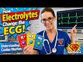 How Electrolytes Change the ECG & What Nurses Can Do To Help Cardiac Arrhythmias