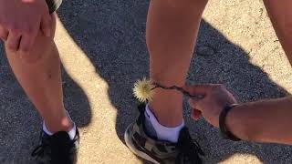 Guy Flicks Cactus Stem From One Leg to Another - 981795