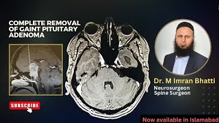 Complete removal of Gaint Pituitary adenoma from a young patient | Neurosurgeon | Spine Suegeon