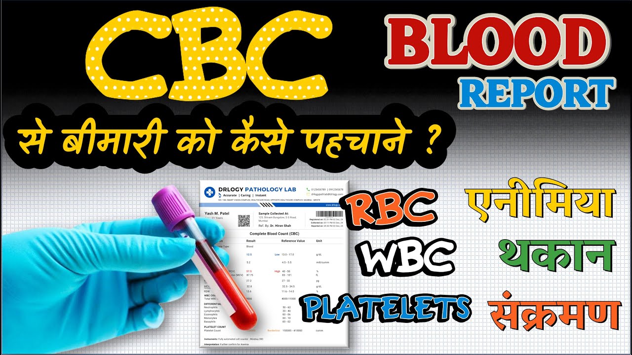 खून की जांच से बीमारी कैसे पहचाने ? Blood Report analysis || CBC || HB || WBC || Platelets