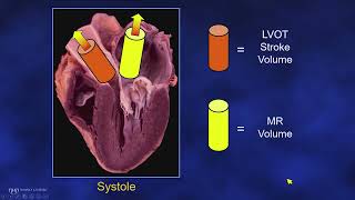 ASE 2021 Hemodynamic Assessment of Mitral Regurgitation