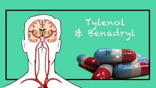 How To Treat Your Headache Tylenol & Benadryl