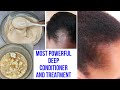 DIY Deep Conditioner, This Treatment Will Stop Your Hair Shedding, Breakage Loss Fall Thinning Edge