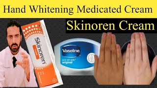 Hand Whitening With Skinoren Cream How To Use Skinoren For Hand Whitening Dr Nadeem Pharmacist