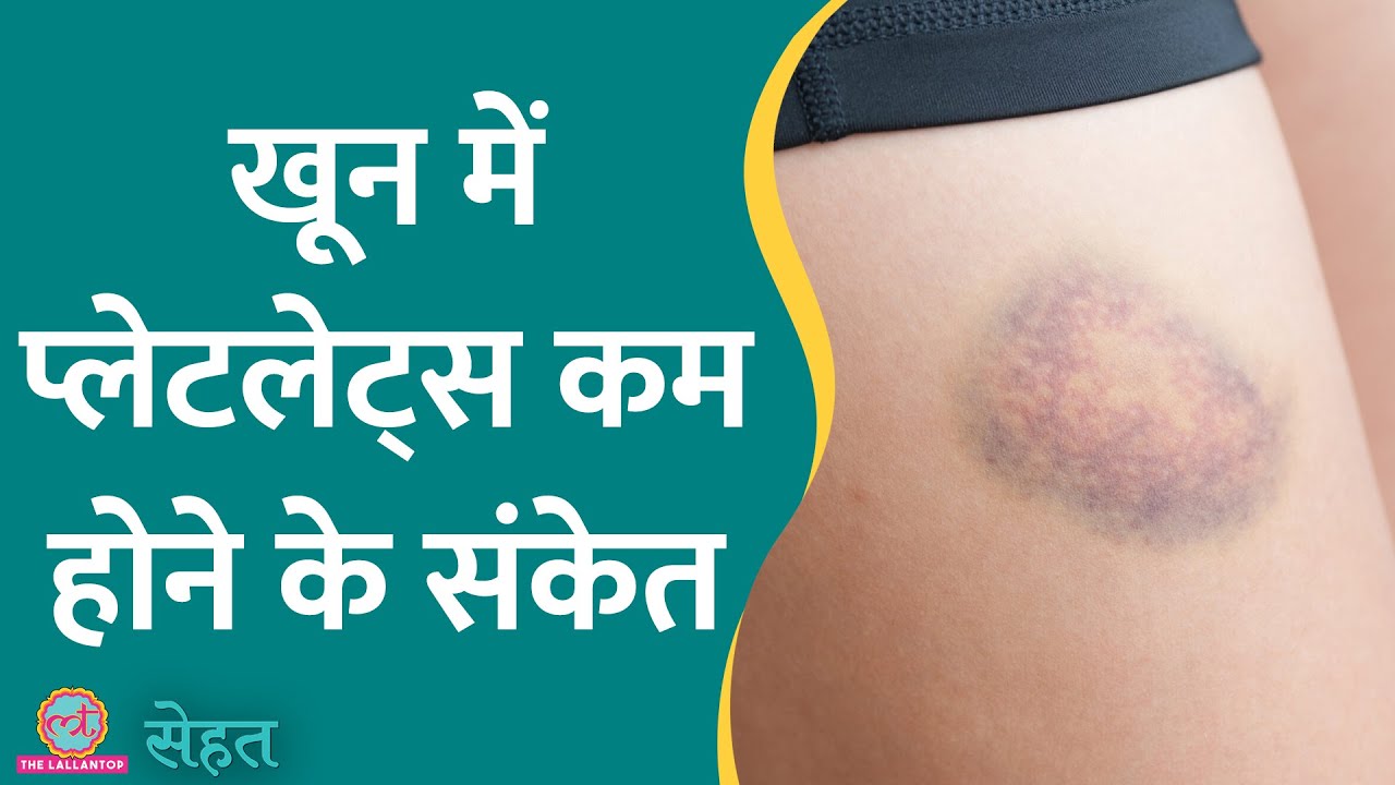 क्या होते हैं Blood Platelets और ये शरीर में क्या काम करते हैं? | Sehat ep 596