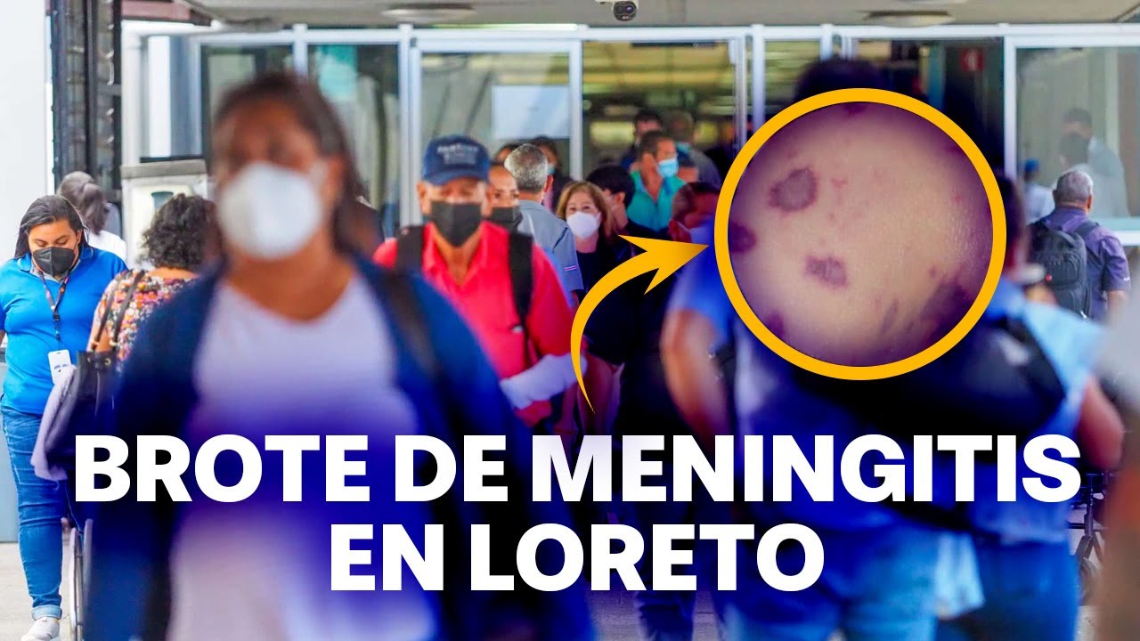 ALARMA POR BROTE DE MENINGITIS EN LORETO: ¿CUÁNTOS CASOS HAY? - YouTube