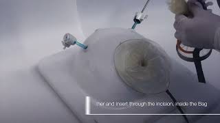 Guardenia™ In-service Video for Manual Tissue Extraction During Laparoscopic Gynecologic Surgery