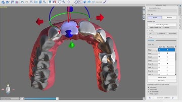 BlueSkyPlan Ortho v4.2.5 - (7) - Movement Evaluation