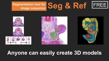 Introduction to "Seg & Ref" Segmentation Tool for Image Sequence