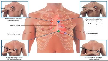 KHÁM TIM LÂM SÀNG | THỰC HÀNH CẬN LÂM SÀNG VUTM | BÍ KÍP HỌC Y HIỆU QUẢ
