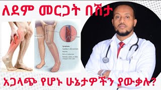 የደም መርጋት በሽታ መንስኤዎች / Deep vein thrombosis (DVT) | Dr. Yonathan | kedmia letenawo