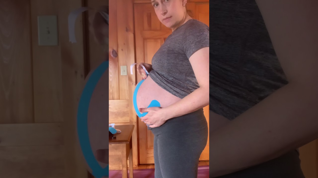Toronto Pregnancy Kinesio Taping