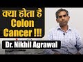 Colon Cancer Symptoms, Causes & treatment by Dr. Nikhil Agrawal | कोलोन कैंसर पर पूरी जानकारी