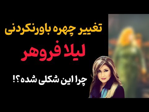 لیلا فروهر از زیبایی گذشته تا تغییرات شگفت انگیز