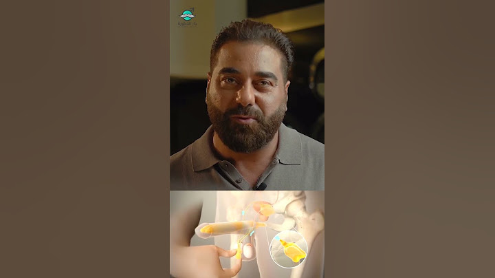 تكوين الدعامة الهيدروليك الثلاث قطع و طريقة الاستخدام مع دكتور أسامة غطاس