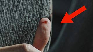 The Guy Cuts His Finger, and it Leds to Irreversible Consequences...