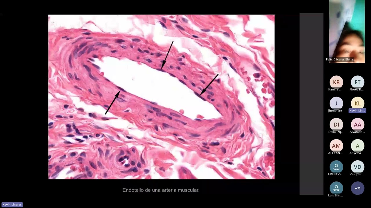 Coagulación y hemostasia - Dr Linares Wong