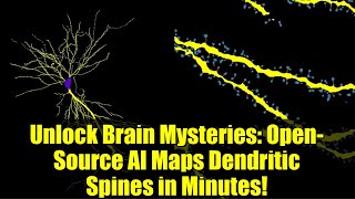 Unlock Brain Mysteries: Open-Source AI Maps Dendritic Spines in Minutes!