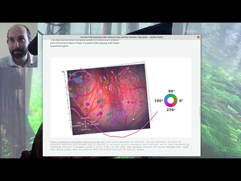 Neuralink Monkey MindPong Deconstructed