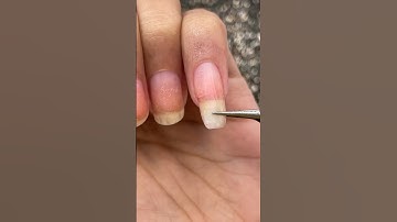 Temporarily Quickly Fixing my "Broken Nail" 🥹😭 Ohhh Noo, Ouchhhh 😩 #nails #nailart #satisfying