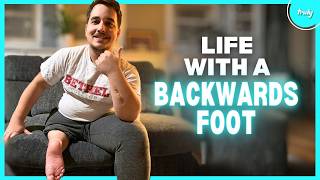My Rare Condition Didnt Stop Me Becoming A Dad | BORN DIFFERENT