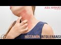 Histamin İntoleransı - Nedir, Belirtileri, Tedavisi | Aslı Aybars