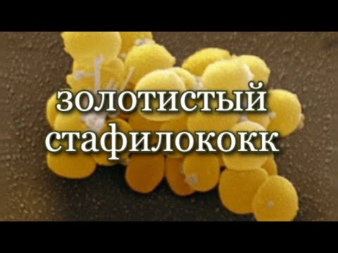 Video: Kako Se Zdravi Staphylococcus Aureus? 12 Najboljših Zdravil Za Zdravljenje Stafilokokov