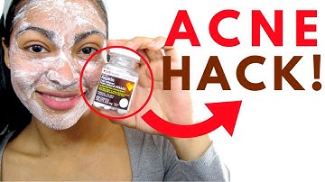 Og hold Atlas Samme ASPIRIN FACE MASK!!! - YouTube