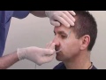 Medical Training Nasogastric Intubation