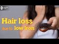 Iron deficiency Hair Loss - Causes, Prevention, Treatment - Dr. Rasya Dixit | Doctors' Circle