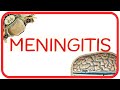 MENINGITIS - fisiopatología, signo de Brudzinski y Kernig, diagnóstico diferencial LCR y tratamiento