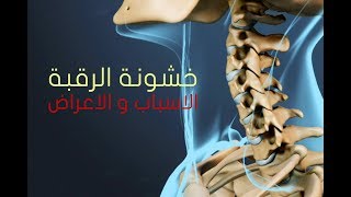 خشونة الرقبه | الاسباب و الاعراض