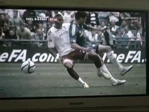 اصابة مايكل بلاك