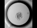 División de un embrión hasta día 5 (blastocisto)