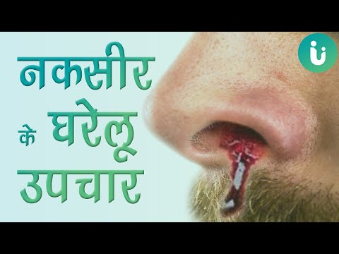 वीडियो: नाक से खून बहने का इलाज कैसे करें?