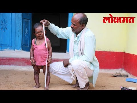 भारत का ये बौना आदमी इस बात पर शर्मा जाता है।जानिए क्या है पूरी बात | Lokmat Hindi News