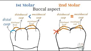 Differences between Mandibular 1st & 2nd Molar