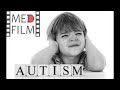 Autism in children - how to identify © Аутизм у детей - диагностика