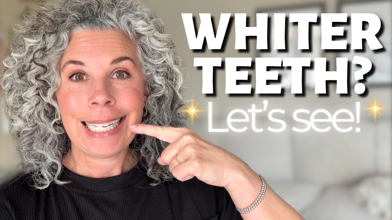 I Bought the Best-Selling Teeth Whitening Kit on Amazon & Tried It At Home.  Did it REALLY Work?