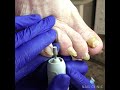 Педикюр при диабете в СПб + зачистка грибковых ногтей
