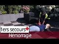 Hémorragie : les gestes de premier secours