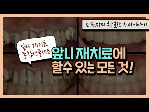 앞니 재치료, 할수있는건 다했습니다.