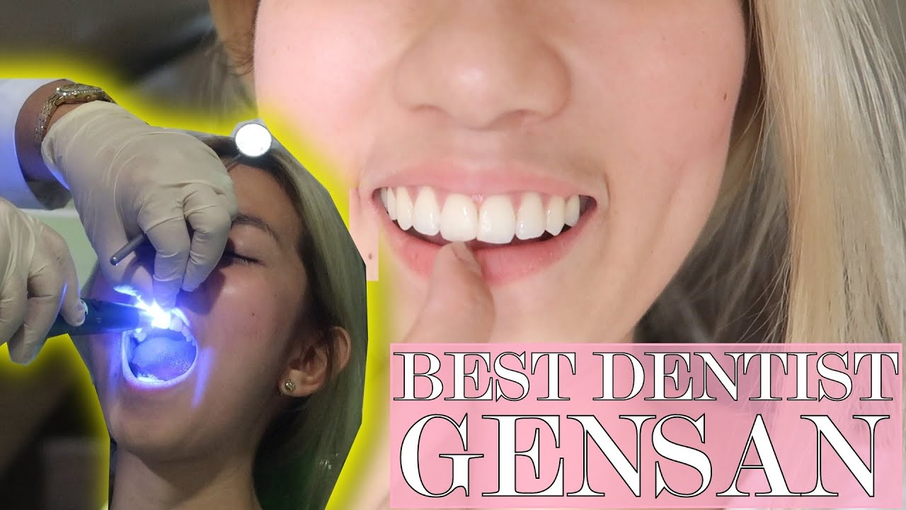 BEST DENTIST IN GENSAN AFFORDABLE PA!! ️ RHEA LORRAINE YouTube