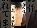 『首が折れた瞬間、何を思ったか』人生で経験することをない経験をした時人は何を思うか#つーはー #車椅子 #障害者 #shorts #shortvideo