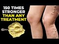 200 times stronger than garlic and lemon! vein varicose treatment! low cost varicose vein treatment