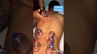 Deep tissue massage ➕cupping #cuppingmassage #massage #eastlosangeles #sobador